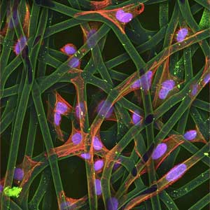 Cultured Cells on Scaffold