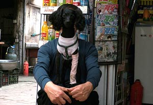 Opposable Thumbs: A New Lease on Life
