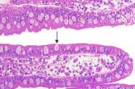 Goblet Cell