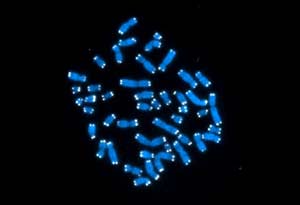 Human Chromosomes