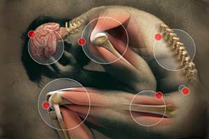 Pain Map