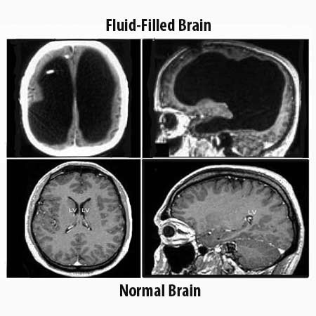 How Much Brain Is Really Necessary?