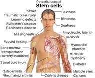 Stem Cell Treatment Uses
