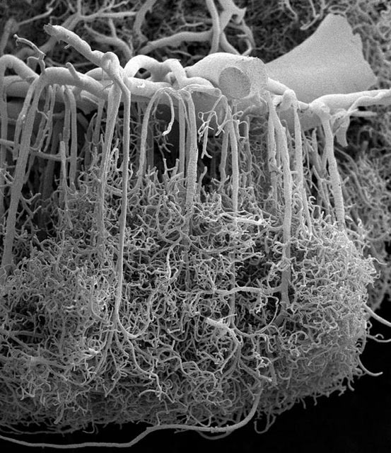 Baroque Brain Blood Vessels