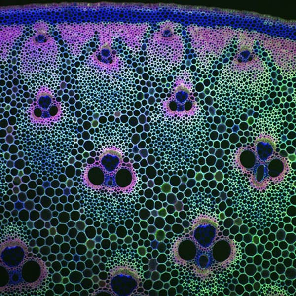 Woody Stalk Cross-Section